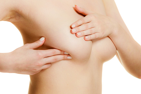breast-mastopexy