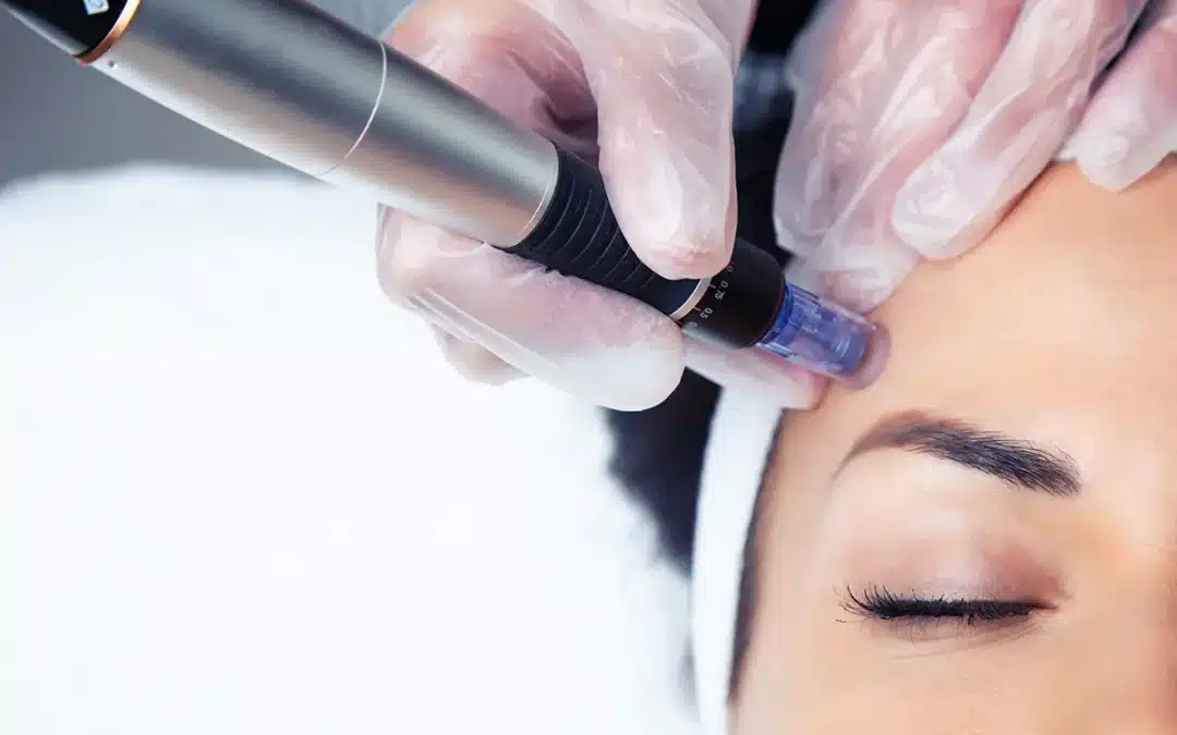 cosmetologist making mesotherapy injection with dermapen on face for rejuvenation on the spa center