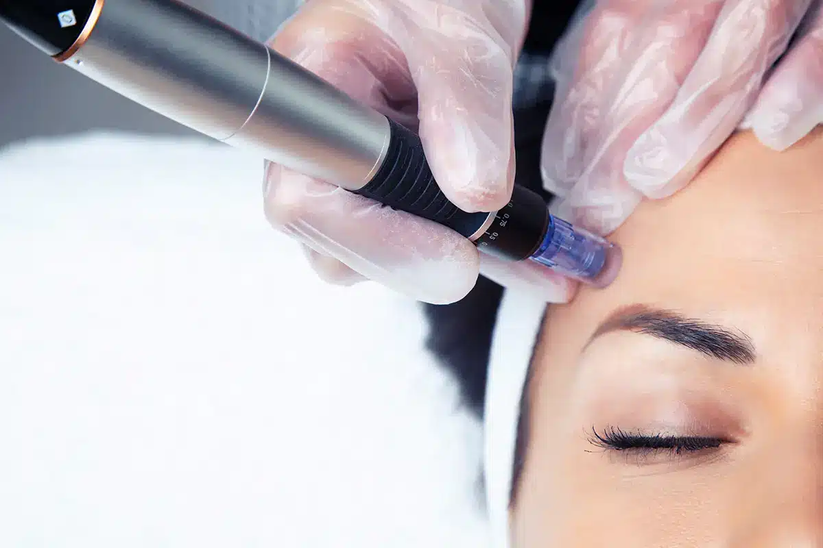 cosmetologist making mesotherapy injection with dermapen on face for rejuvenation on the spa center cosmetologist making mesotherapy injection with dermapen on face for rejuvenation on the spa center