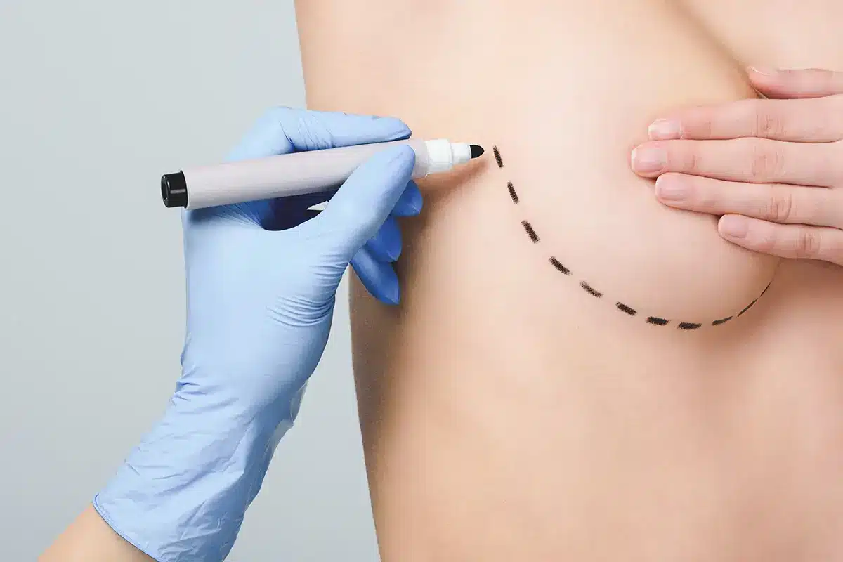 top cosmetic procedures this summer