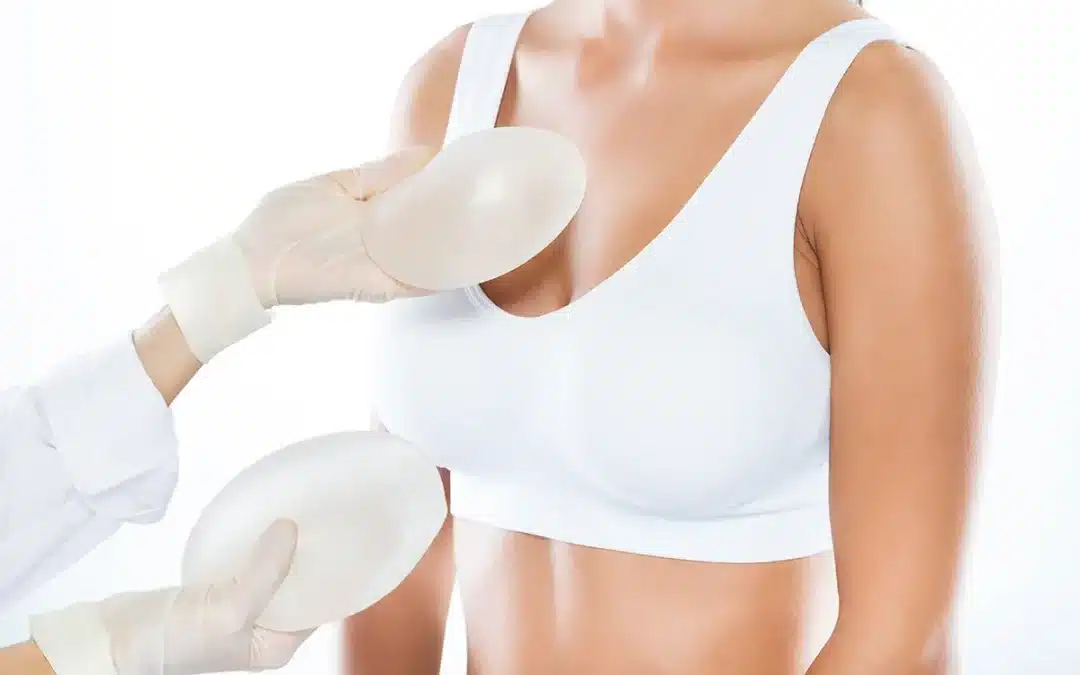 female doctor choosing mammary prosthesis with her patient