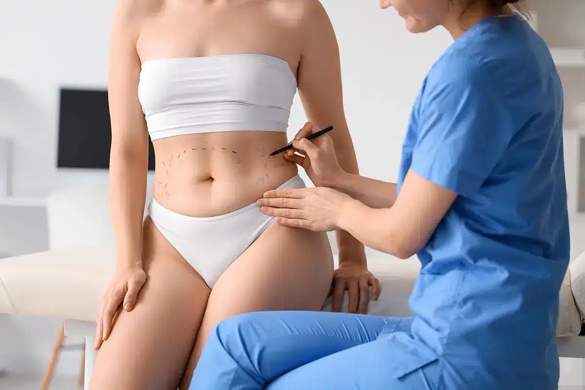 female plastic surgeon marking patients belly in clinic