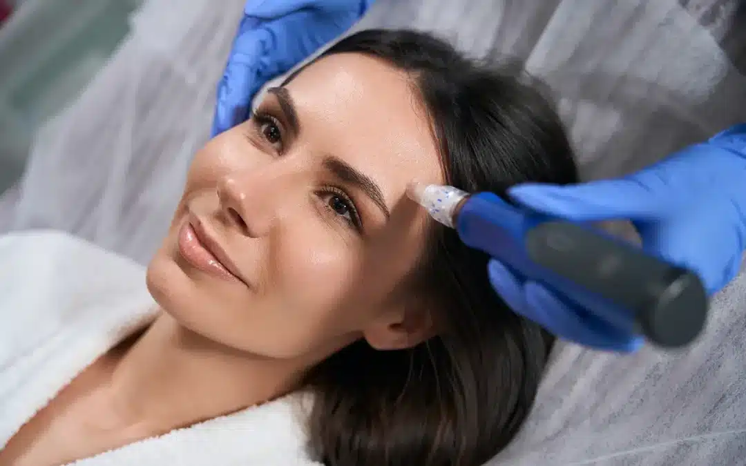top view of female holding device for microneedling