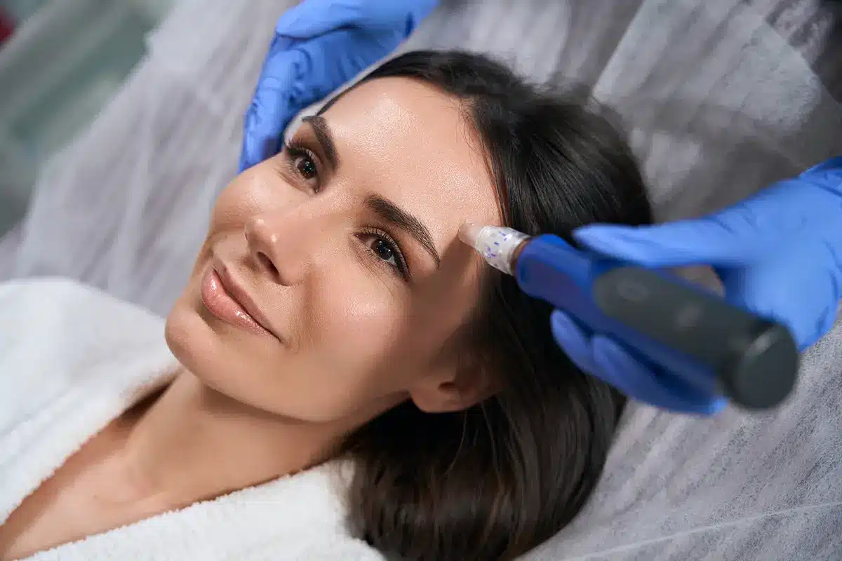 best microneedling facials in bay area